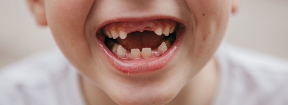 How do Children’s Teeth Erupt and Fall Out?