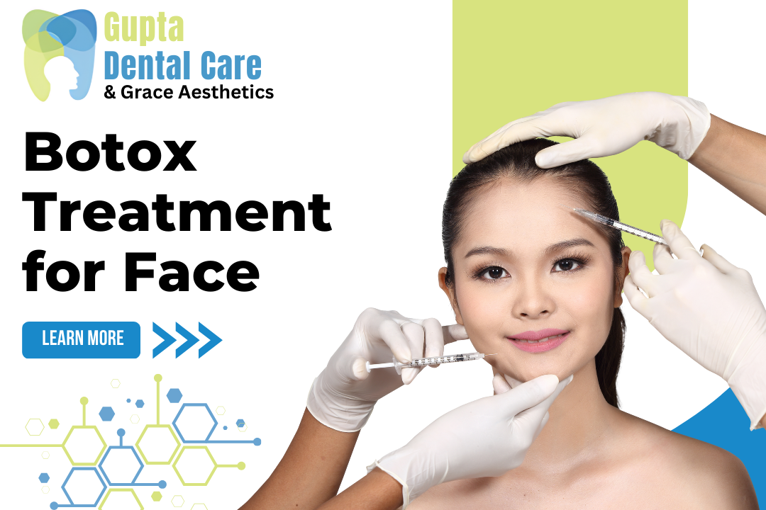 Botox Treatment for Face