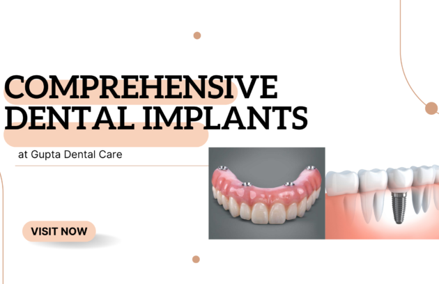 dental implants