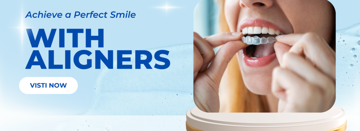 aligners