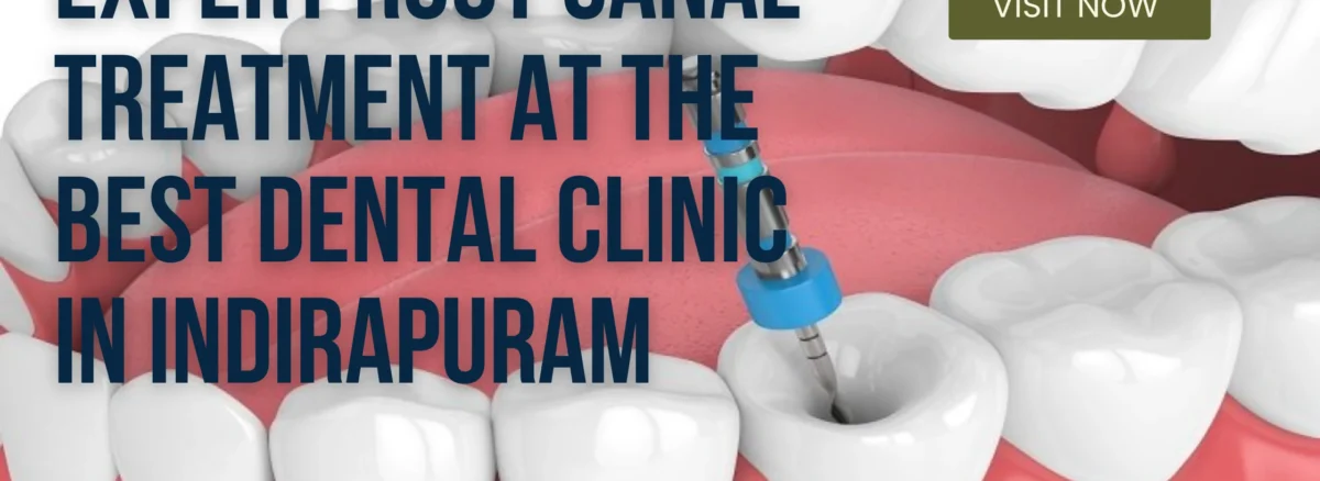 best dental clinic in Indirapuram