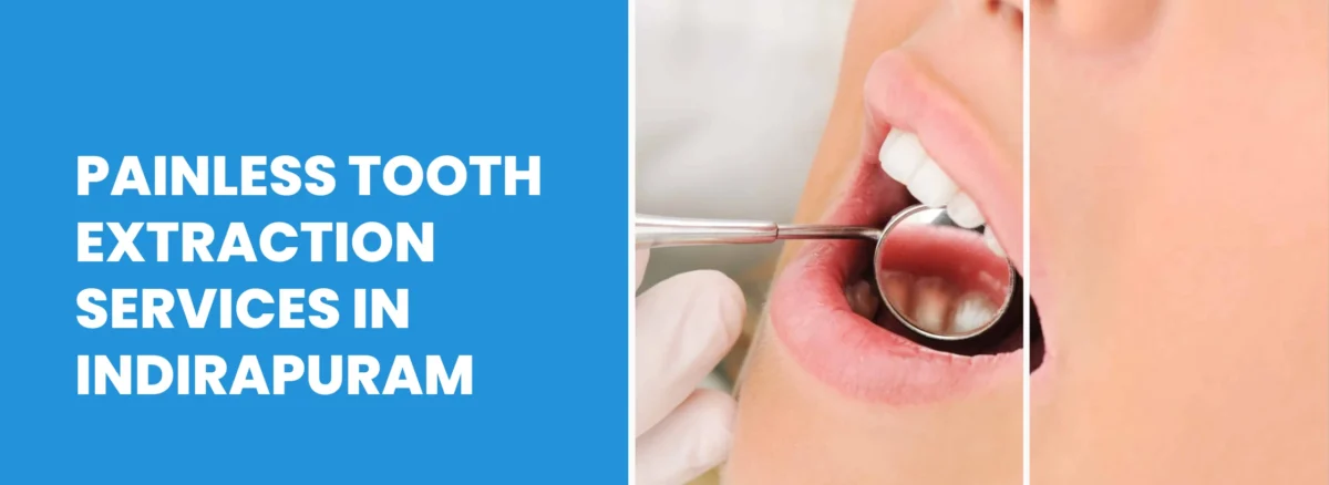 Dentist in Indirapuram