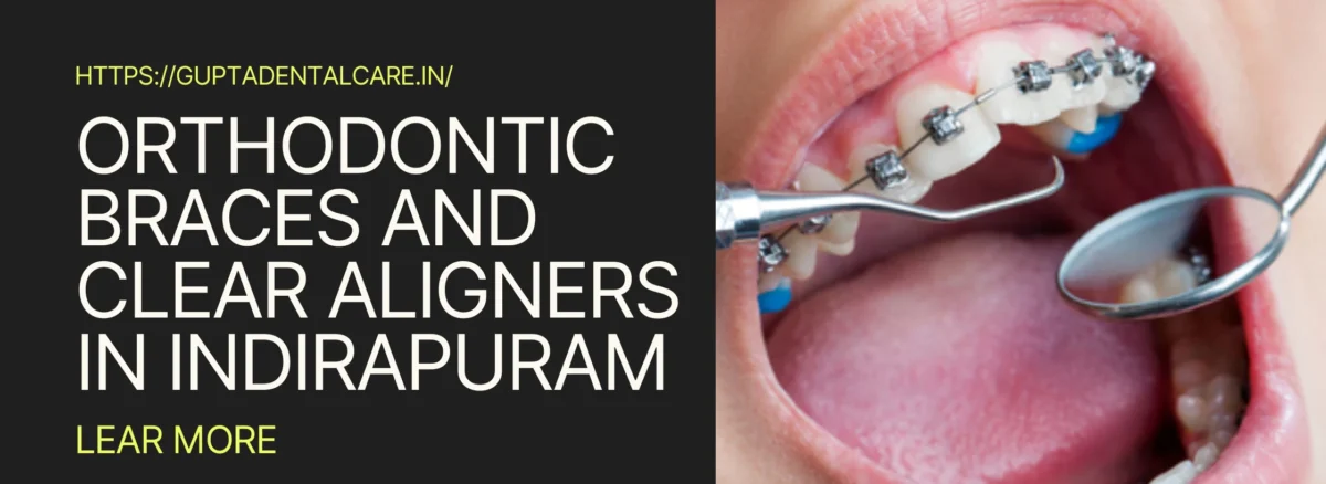 dental clinic in Indirapuram