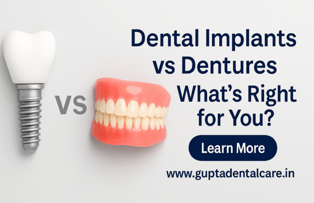 Implant Clinic in Indirapuram