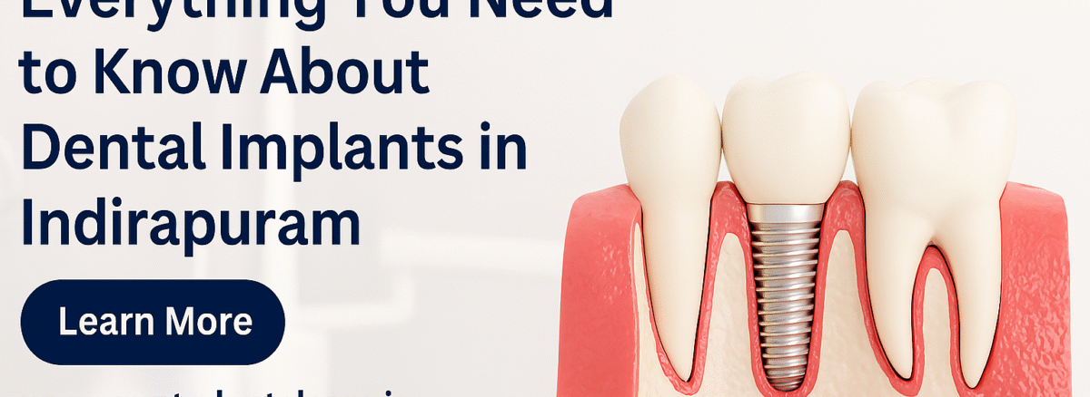Implant Clinic in Indirapuram