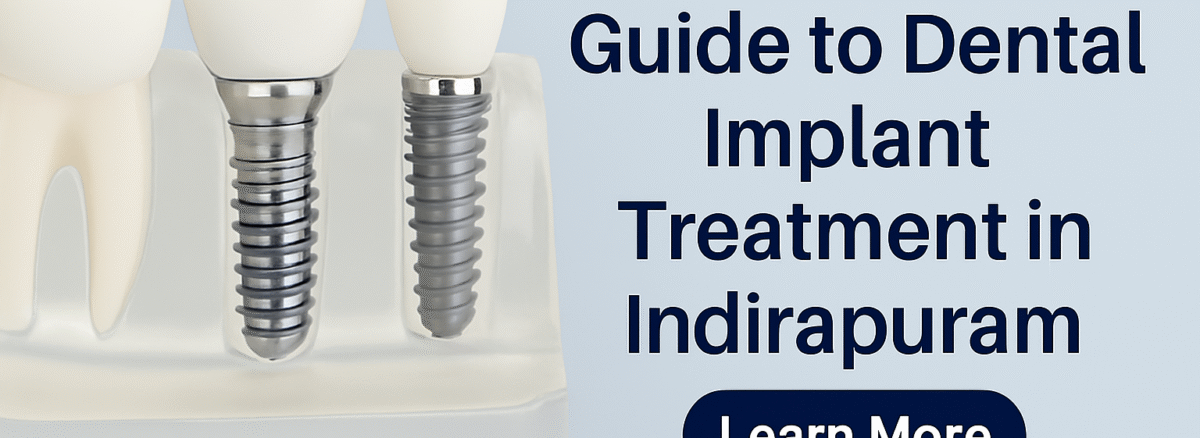 Implant Clinic in Indirapuram