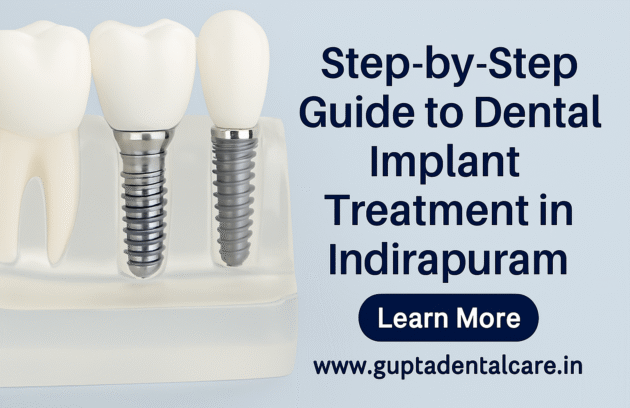 Implant Clinic in Indirapuram
